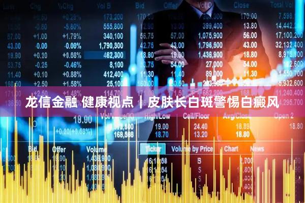 龙信金融 健康视点｜皮肤长白斑警惕白癜风